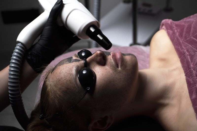 Пілінг Carbon Therapy (карбоновий пілінг)