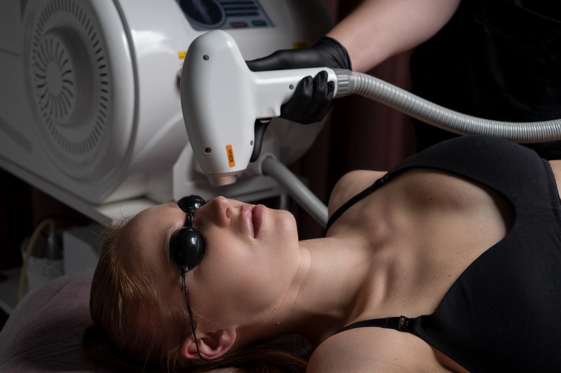 Лазерная эпиляция
