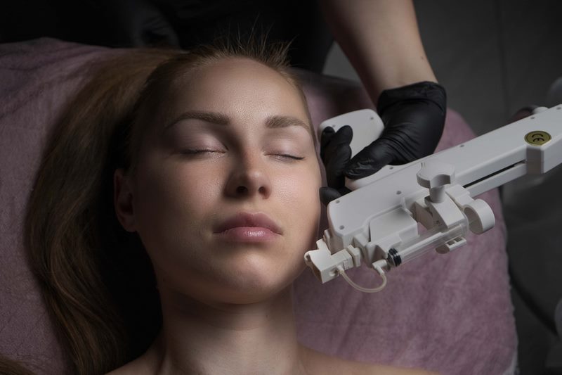 Мезотерапія від акне