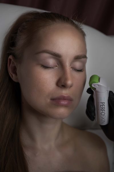 Редермалізація шкіри