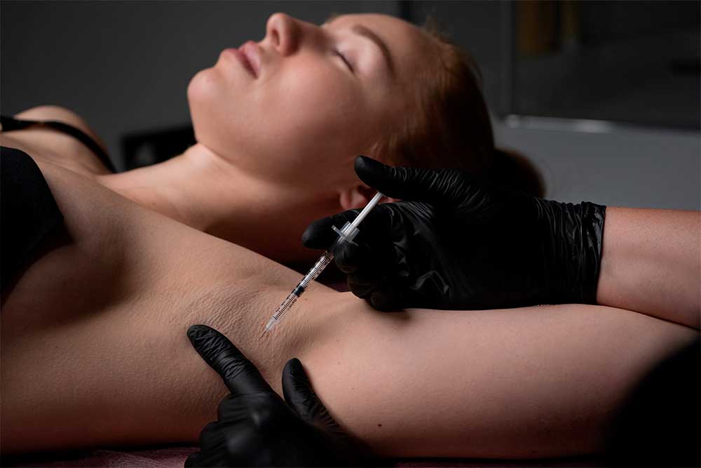 Лікування гіпергідрозу