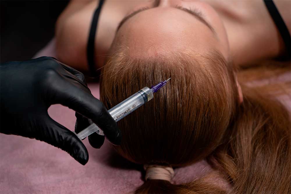 Мезотерапія шкіри голови
